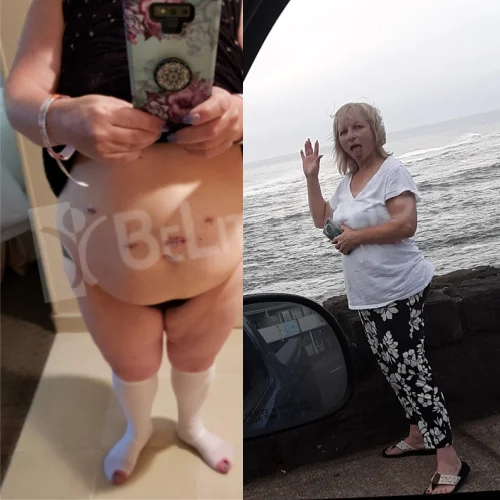 Laura L - 11 Month Update*